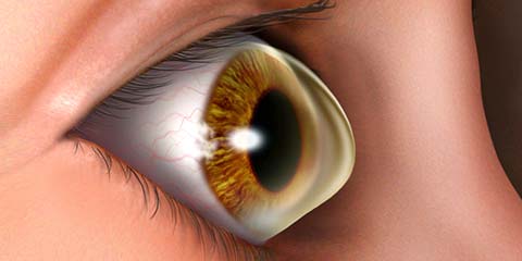 Eye Diseases Management & other Ocular Conditions
